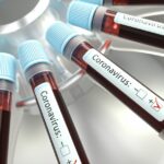 Espanha: O número de casos de coronavírus supera 100.000