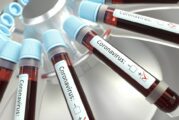 HSE: Atraso de testes de coronavírus foi resolvido