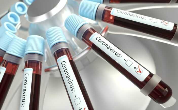 Espanha: O número de casos de coronavírus supera 100.000
